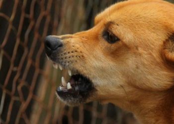 Σέρρες: Σκύλος επιτέθηκε σε 11χρονο – Πολίτες ελευθέρωσαν το πόδι του από τα δόντια του