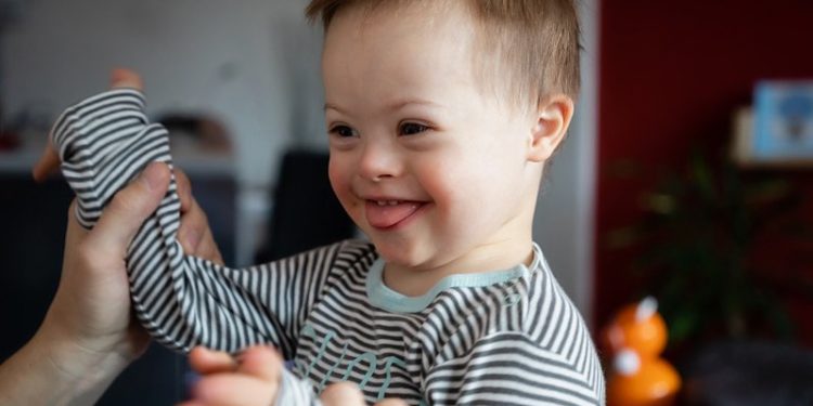 Σύνδρομο Down : Όλα όσα πρέπει να γνωρίζετε