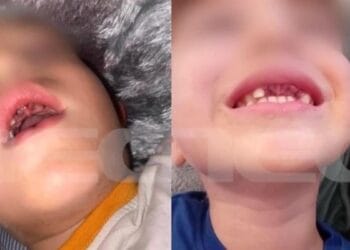 Νέο περιστατικό bullying με παιδιά: 5χρονα χτύπησαν 4χρονο συμμαθητή τους με αυτισμό